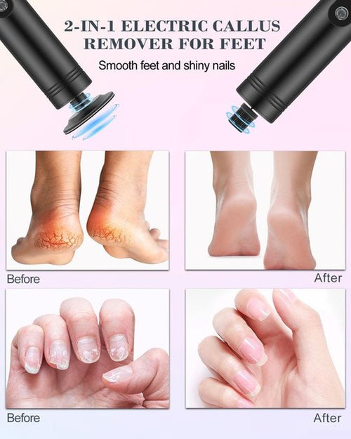 2 in 1 Electric Foot Callus Remover, 9 Speed Adjustable Foot Sander with LED Display, Electric Foot Grinder with 2000 mAh Rechargeable Battery, for Callus Removal, Replaceable Sandpaper Discs (Black)