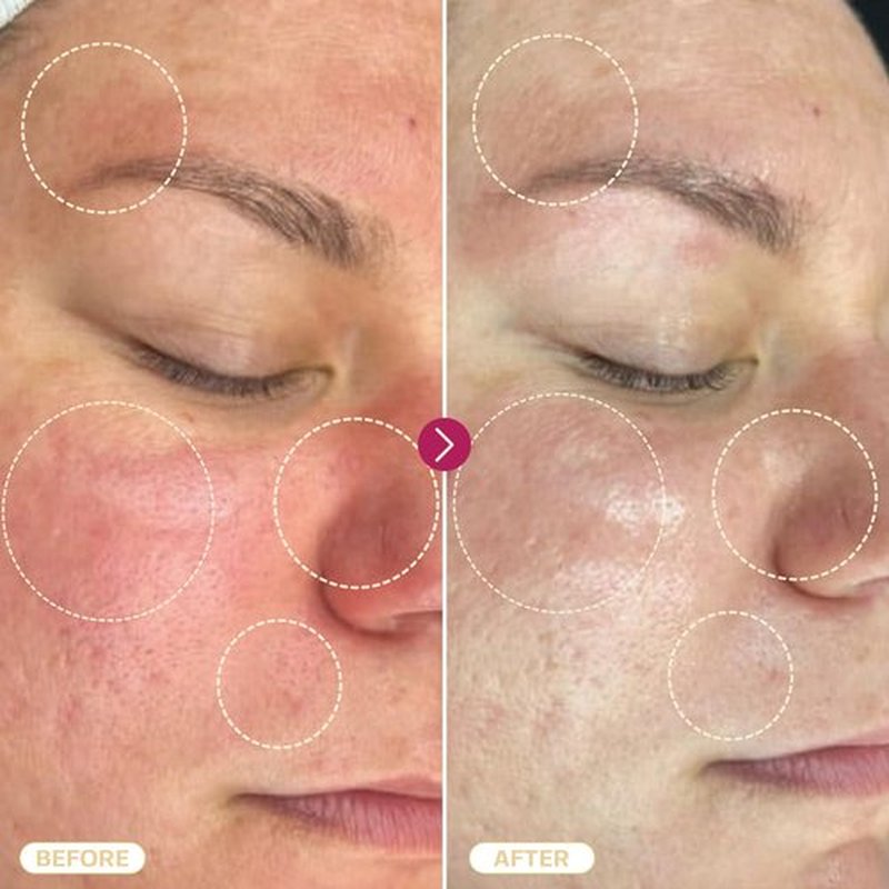 BASE LABORATORIES Hypochlorous Acid Spray for Face & Skin | 8 oz | Facial Daily Skin Repair Solution for Sensitive Skin, Redness, Irritations, Eczema, Acne. Hypochlrous HOCL Molecule Spray