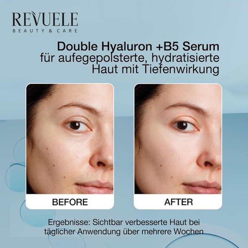 Revuele Double Hyaluron + B5 Serum - Hydrating Face Serum with Hyaluronic Acid & Panthenol, 1 fl. oz.