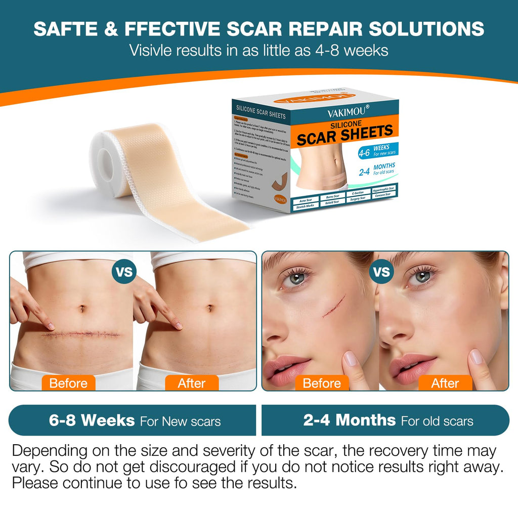 Silicone Scar Sheets,Silicone Scar Tape, Professional Scar Removal, Silicone Scar strips for Surgical scars tape, C-Section,Tummy Tuck (1.6x11859''Roll-3.0M) Keloid bump removal