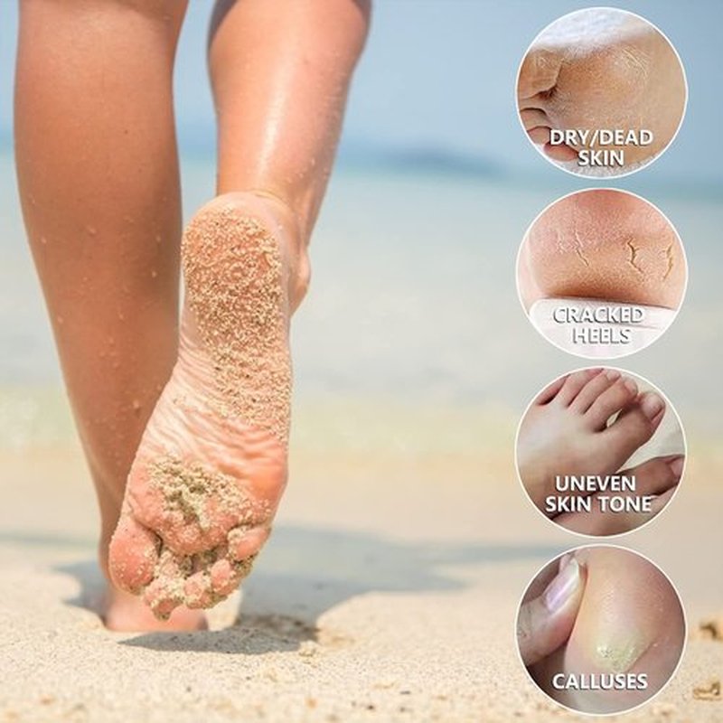 5 Pack Foot Peeling Mask,Exfoliator Peel Off Calluses Dead Skin Callus Remover,Foot Mask for Dry Cracked Feet,Foot Peel Masks for Men and Women Feet Peeling Mask for Valentines Day Gifts