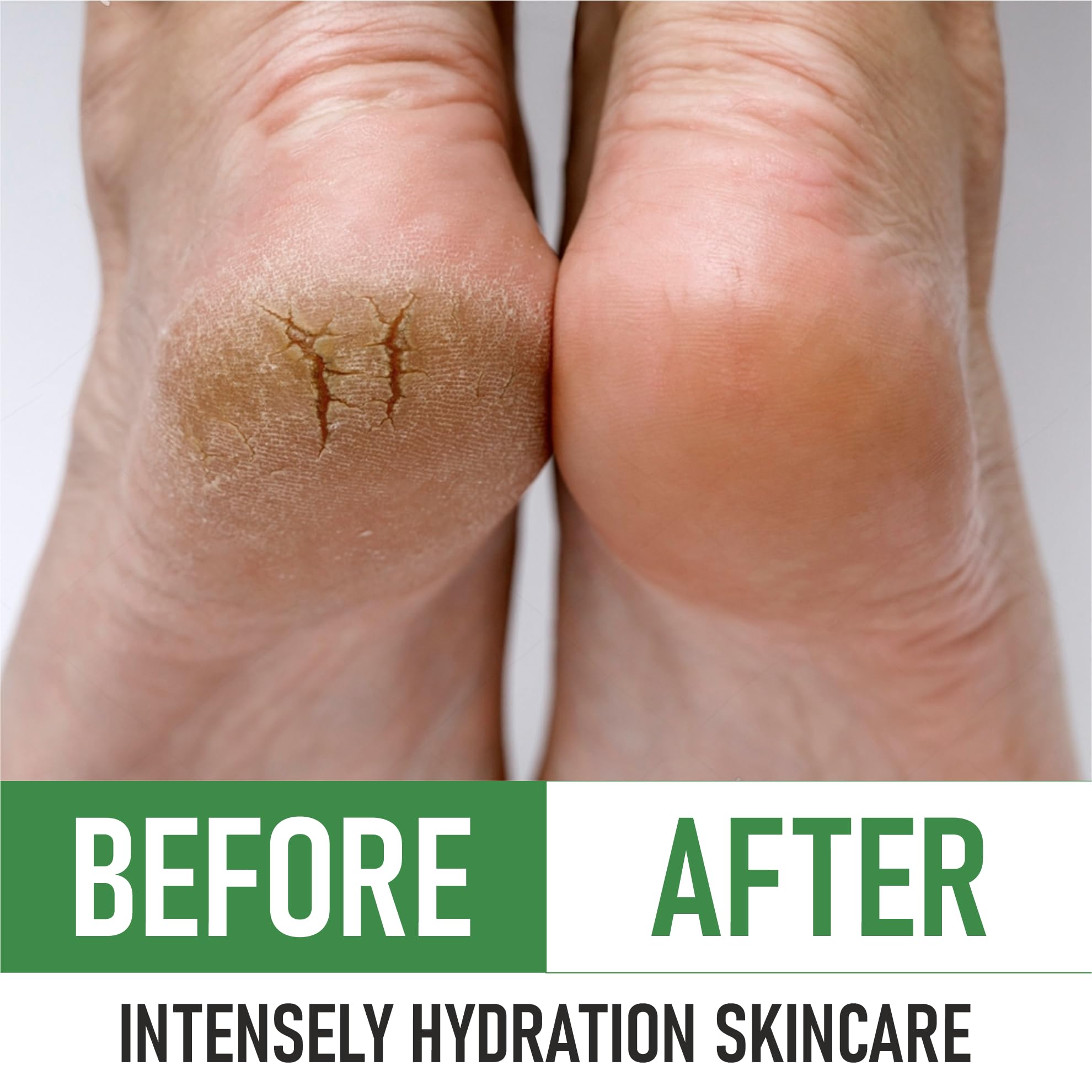 PurOrganica Urea Cream 20% – Made in USA, Maximum Strength Foot Cream for Dry, Cracked Heels, Corns, Calluses & Rough Feet, Exfoliating Moisturizer