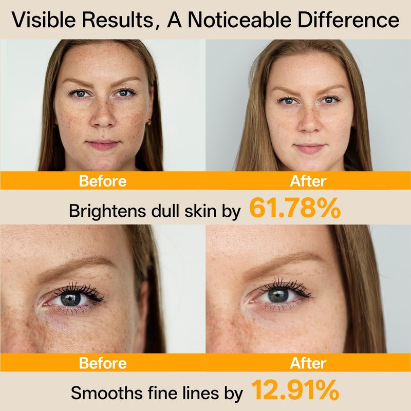 WNP Vitamin C Serum for Face - Dermatologist Tested Anti-Aging & Brightening with Hyaluronic Acid & Vitamin E, Treatment for Dark, Age, Sun Spot, Melasma, Hyperpigmentation, Fine Lines & Wrinkles