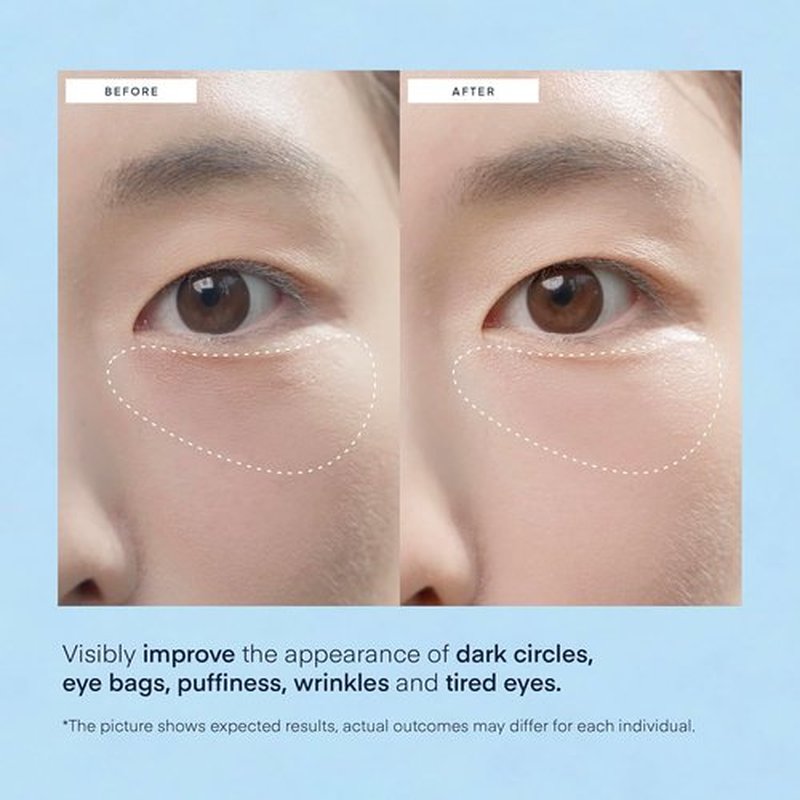 Terez & Honor Under Eye Patches - 60 Korean Hydrogel Masks for Dark Circles & Puffiness | Hydrating, Vegan, Fragrance-Free