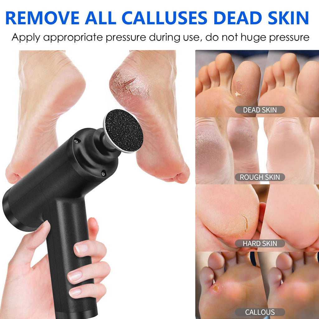 Upgraded Electric Callus Remover for Feet 4500rpm, Adjustable Speed Professional Electric Foot Sander Grinder Foot File for Calloused Feet Dead Hard Cracked Skin, with 4 Interchangeable Heads (Black)