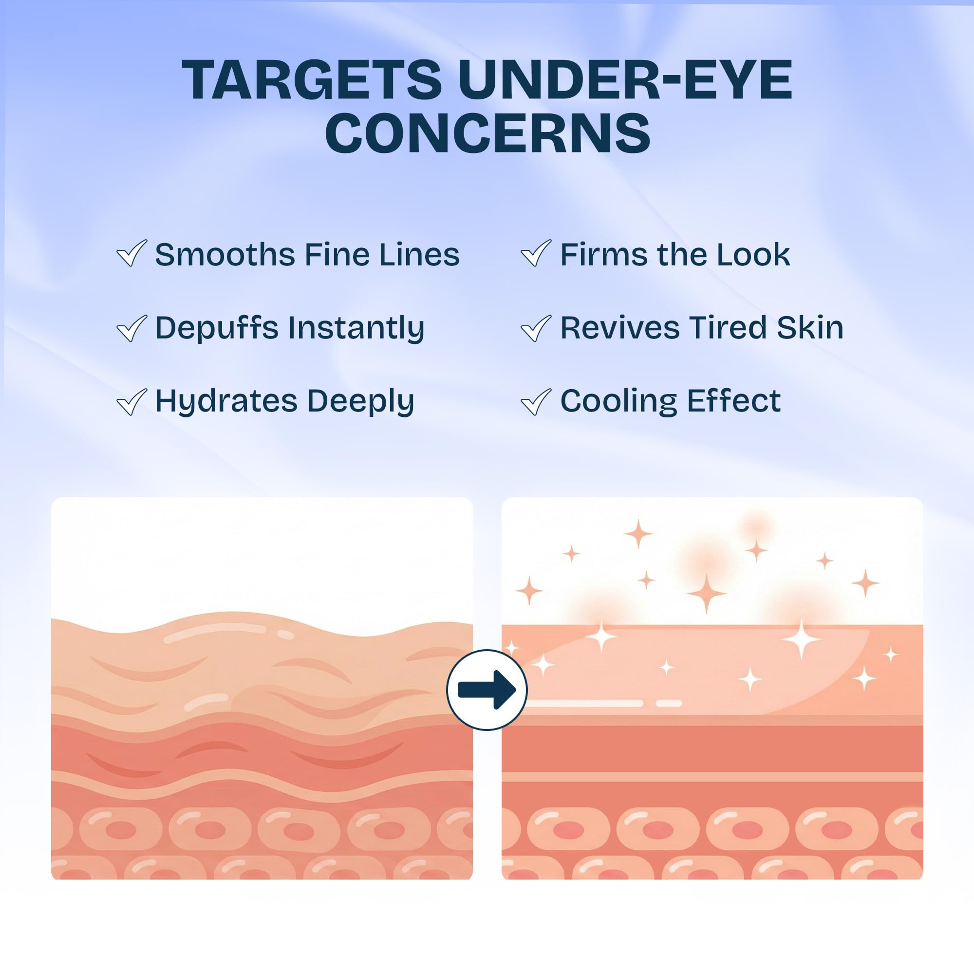 MAREE Under Eye Patches for Puffy Eyes and Dark Circles – Under Eye Mask with Collagen & Hyaluronic Acid – Undereye Mask Patches for Women – Parches para Ojeras Puffiness & Under Eye Bags | 12 Pair