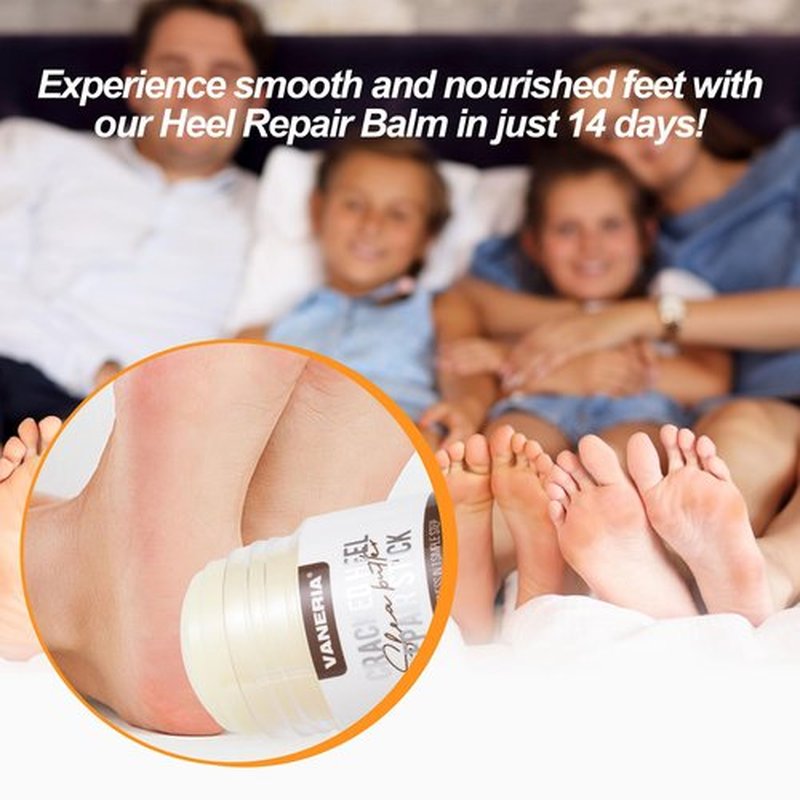 Grospe Shea Butter Dry Cracked Hands and Feet Repair Stick, Moisturizing Foot Cream with Shea Butter and Coconut Oil，Moisturizes and Softens Heels, Gently Exfoliates and Improves Dry Skin，1.41 OZ