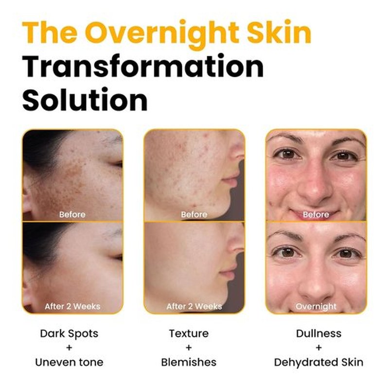 MEFELE Cln Peel Off Mask,Collagen Face Mask, Hydrating Overnight Hydrogel Mask,Gentle Skin Care, Pore Minimizing - Korean Skincare -Elasticity Improvement - Better Than Sheet Masks