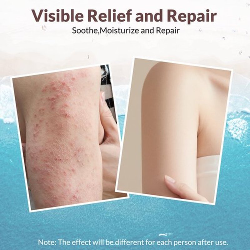 Crogooe Natural Soothing Eczema Cream for Dry & Itchy & Sensitive Skin - Fragrance-Free Moisturizer with Sea Moss, Aloe Vera & Oats for Intense Hydration & Comfort ，Safe for All Ages (4 oz)