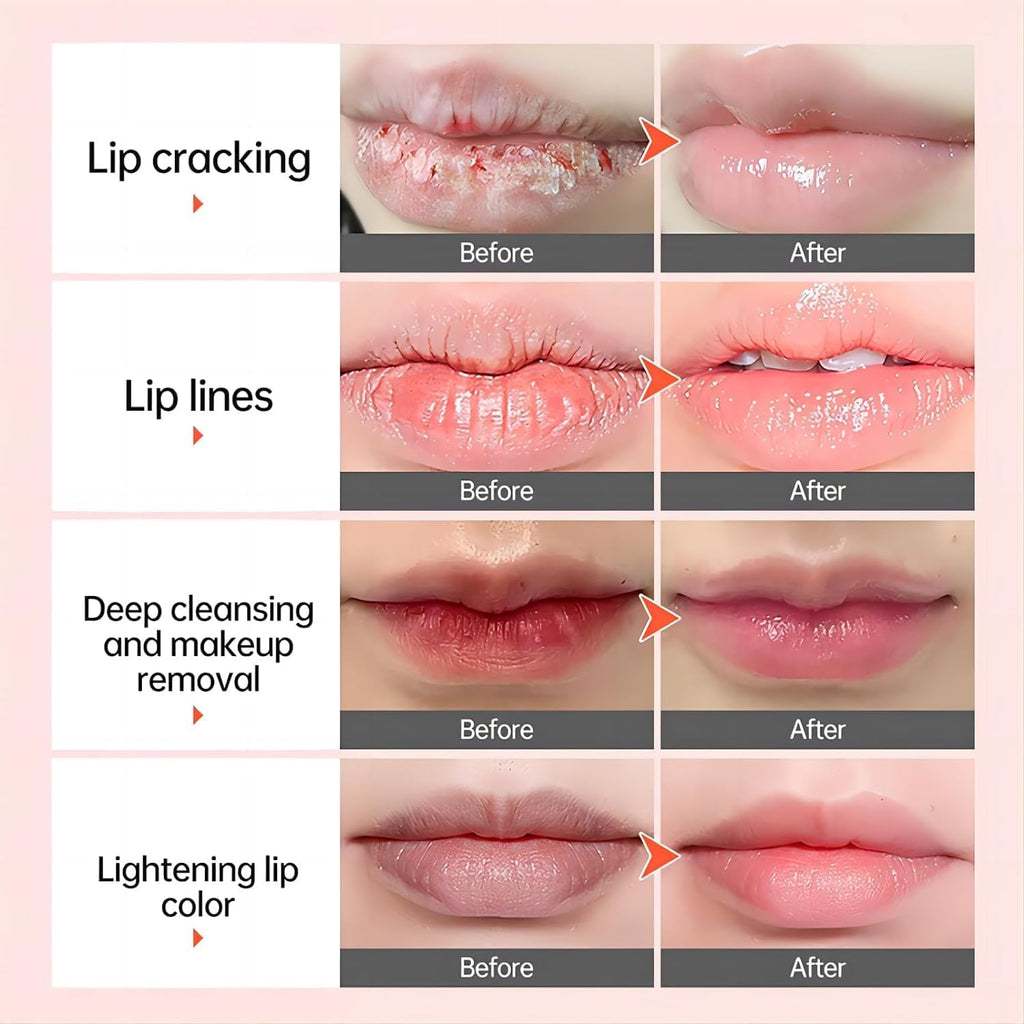 Lip Lightening Balm Dark Black Removal Exfoliation Pigmentation Fade Dull Pink Balm Anti-Crack Moisturizing Nourishing Lip Care Smokers and Non-Smoker