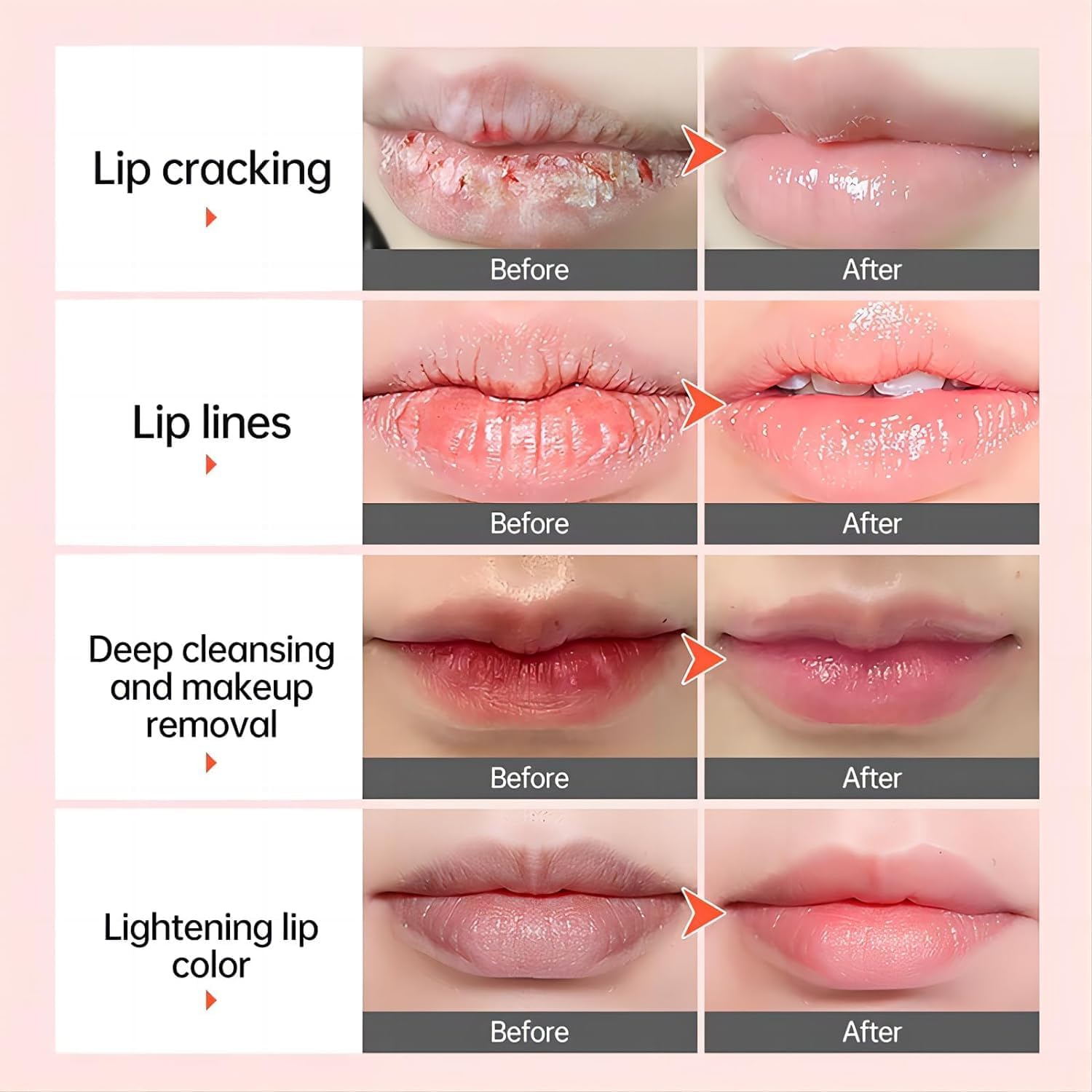 Lip Lightening Balm Dark Black Removal Exfoliation Pigmentation Fade Dull Pink Balm Anti-Crack Moisturizing Nourishing Lip Care Smokers and Non-Smoker
