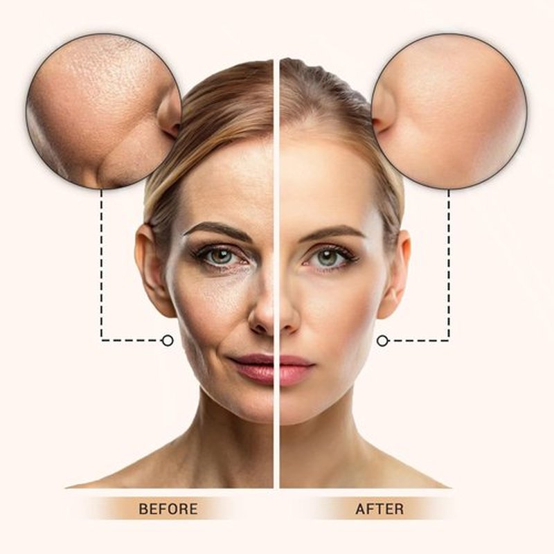 Lx Blend Bye Bye Foundation - Oil-Free Matte Coverage Moisturizer with SPF 50 | Medium, 1 FL OZ