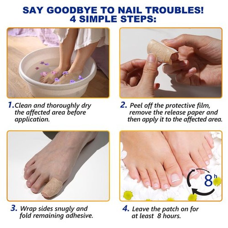 Toenail Treatment Extra Strength-8-Hrs Overnight Nail Repair,ingrown toenail treatment,Strengthens Brittle Nails,Improves Texture & Thickening Hypoallergenic Easy (64 Patch)