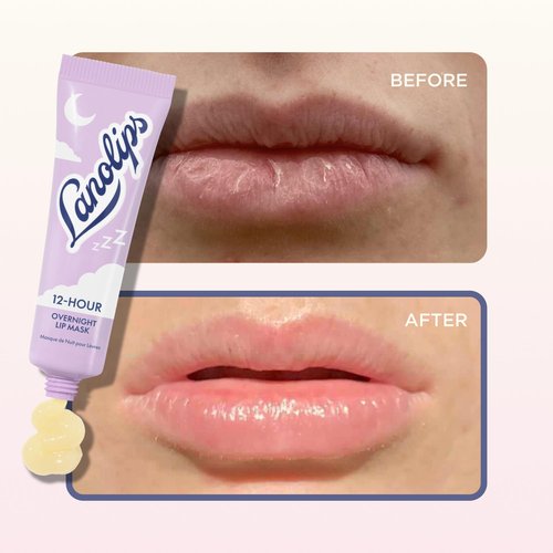 Lanolips 12 Hour Overnight Lip Mask - Rich Lanolin Lip Balm with Hyaluronic Acid, Vitamin C & Ceramides - Restore, Soften & Replenish While You Sleep - Cruelty-Free Hydrating Balm (0.52 oz / 15 g)