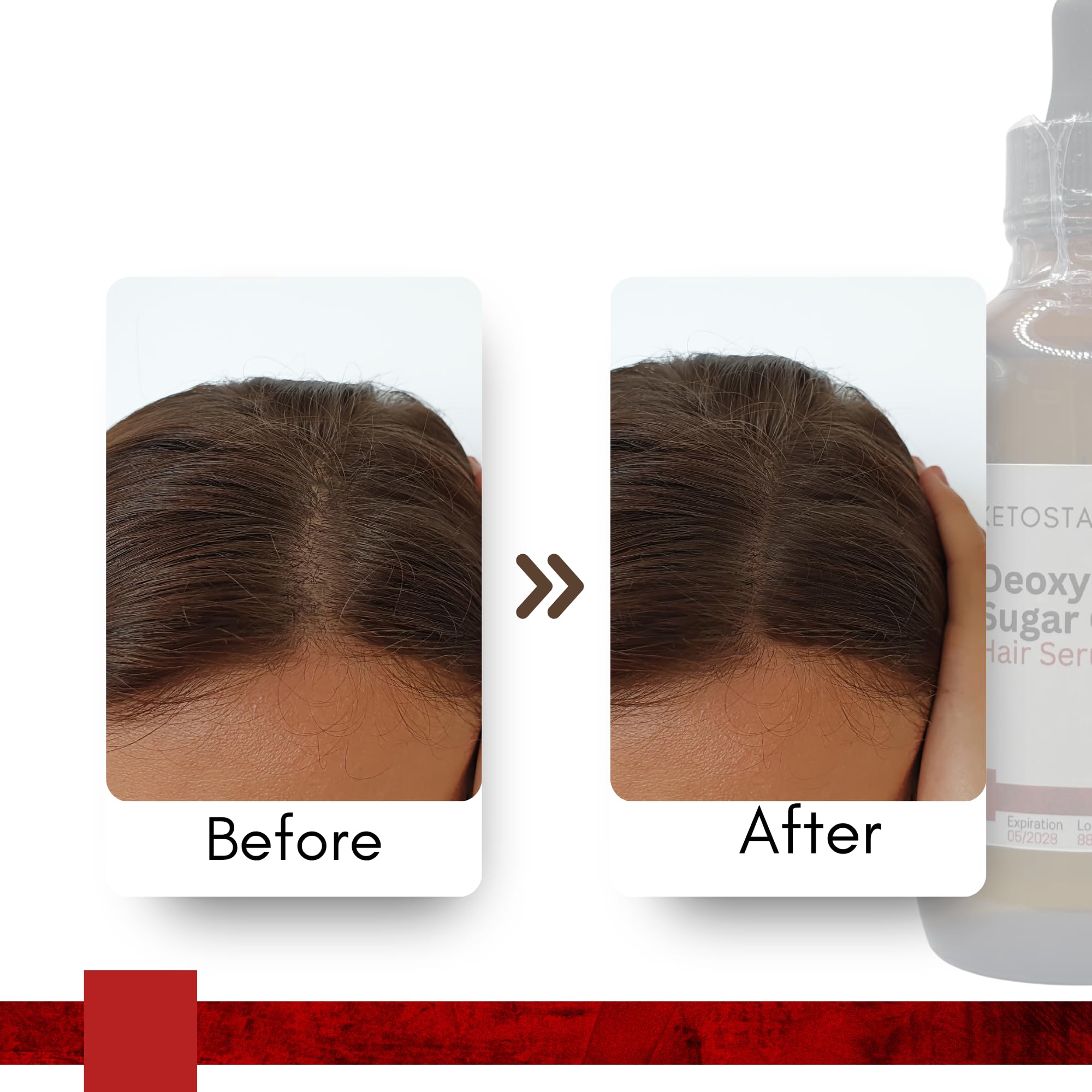 Ketostat Deoxyribose Sugar Gel 2-Deoxy-d-ribose 2dDR Hair Growth 110ml / 3.75 oz - Backbone of DNA - Stimulate the Formation of new Blood Vessels for Men or Women