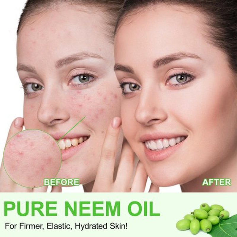 APUUFYQC Neem Oil for Skin, Pure Natural Cold Pressing, Free of Hexane, Nourishes the Skin and Hair, Reduces Fine Lines, 2.02 Oz