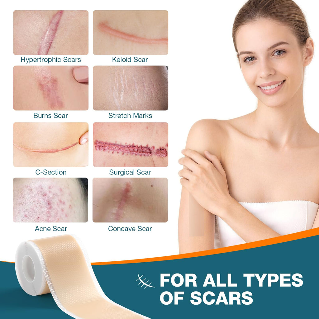 Silicone Scar Sheets,Silicone Scar Tape, Professional Scar Removal, Silicone Scar strips for Surgical scars tape, C-Section,Tummy Tuck (1.6x11859''Roll-3.0M) Keloid bump removal
