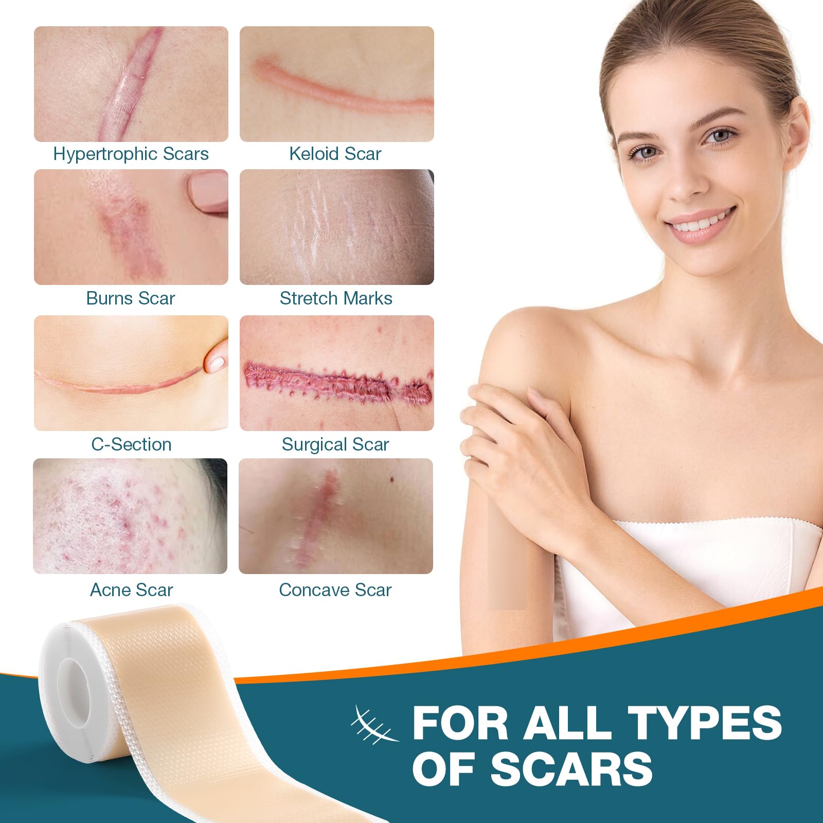 Silicone Scar Sheets,Silicone Scar Tape, Professional Scar Removal, Silicone Scar strips for Surgical scars tape, C-Section,Tummy Tuck (1.6x11859''Roll-3.0M) Keloid bump removal