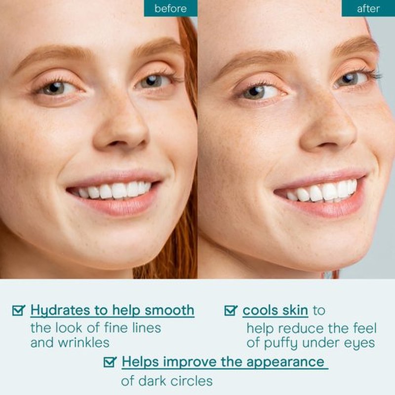 Baebody Under-Eye Gel - Advanced Cooling Cream for Dark Circles & Puffiness - Hydrating Anti-Aging Formula (50 ml)
