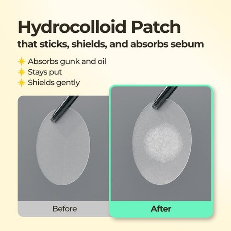 SINSURU BHA Iconic Spot Patch with Mirror Case - Hydrocolloid Patches with 5,000ppm Salicylic Acid - Day & Night Zit Patch for Targeted Sebum Care & Stylish Wear