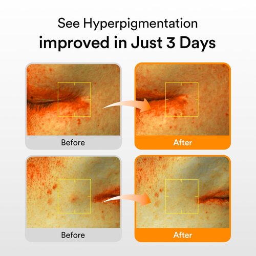 Abib Glutathiosome Dark Spot Serum Vita drop 1.69 fl.oz. | Korean Skincare, Dark Spot, Hyperpigmentation Treatment | Serum for Sensitive, Uneven Skin