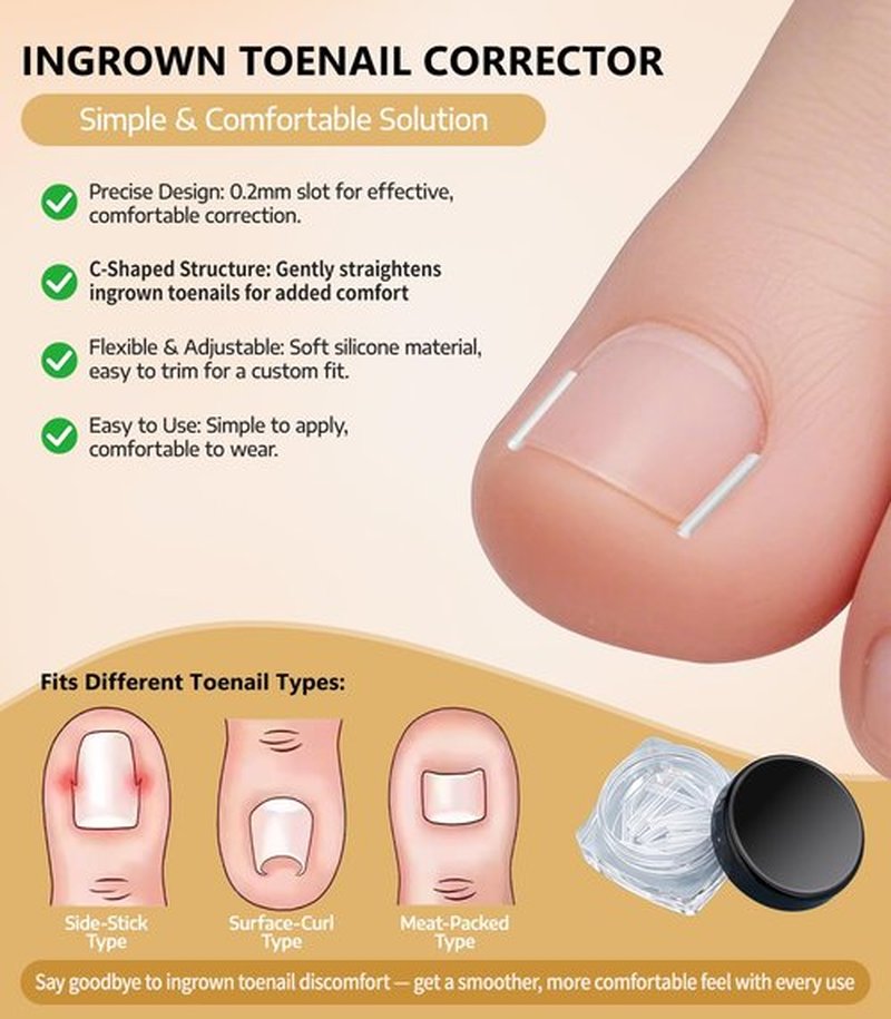 Ingrown Toenail Corrector Set with 50 Positive Nail Strips & 20 Breathable Patches, Professional Pedicure Tool Kit for Curved Toenails, Easy to Use for Beginners