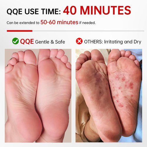QQE 3 Pack Foot Peeling Mask, Hydrating Exfoliating Foot Mask for Dry Cracked Feet, Callus Remover & Cracked Heel Repair & Foot Care