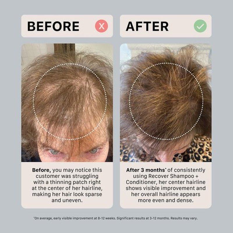 ACTIIV Recover Travel Duo For Women - Plant-Based Hair Care for Fuller, Healthier-Looking Hair | Color-Safe, Vegan