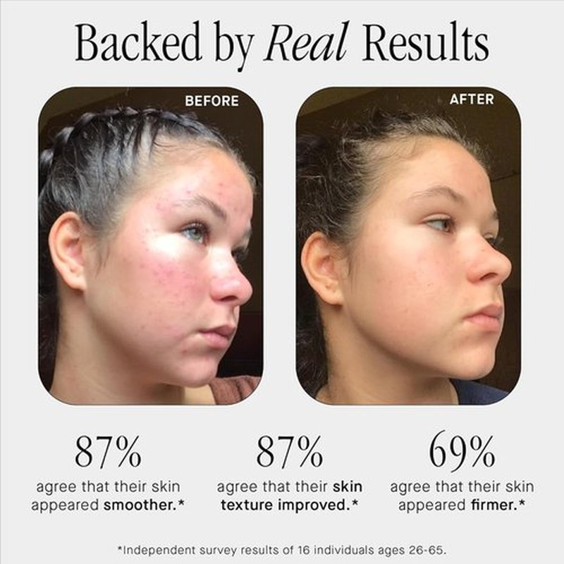 Brandefy Niacinamide Serum - Hydrating & Plumping with Peptides & Hyaluronic Acid | 1oz Made in the USA