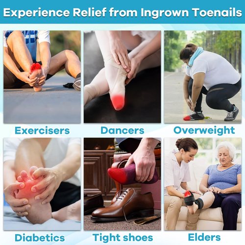 Ingrown Toenail Drop - Ingrown Toenail Pain Reliever and Softener Kit for Men Women Ingrown Toenail Corrector Drops