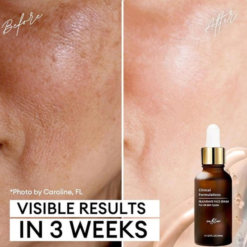 Rejuvenate Resurfacing Face Serum - Anti-Aging Serum for Wrinkles & Dark Spots - 1 fl. oz.