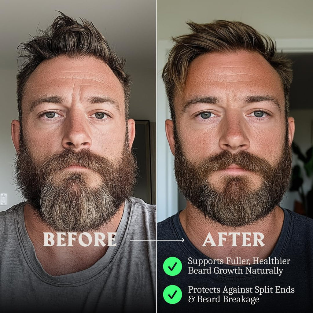 Striking Viking Beard Growth Oil with Biotin - 2 Fl Oz, Unscented - Thickening, Conditioning Biotin Beard Growth Serum for Men with Argan & Jojoba Oil - Facial Hair Serum for Men