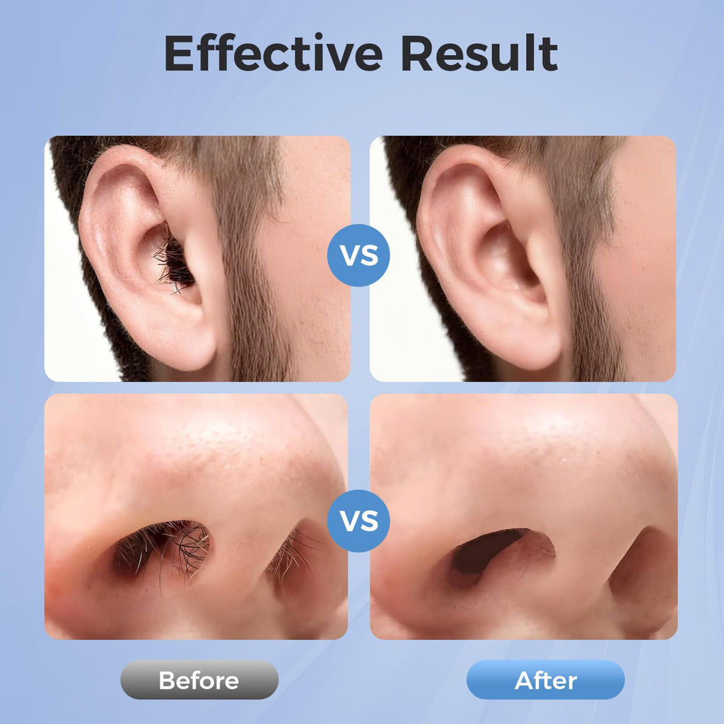 Nose Wax Kit Men: Nose and Ear Hair Removal Kit with Smart Temperature Control & USB C Fast Heating, Nose Hair Wax Kit Includes 100g Hard Wax Beans 20 Sticks & Travel Bag | Lasts up to 7 Weeks 15 Uses