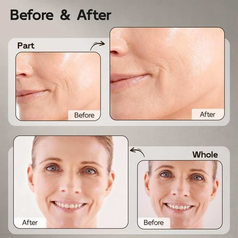 Retinol Serum for Face & Neck, Anti Aging B5 Resurfacing Face Serum with Niacinamide + Collagen + Hyaluronic Acid, Smooths Wrinkles & Fine Lines, Dark Spot Corrector, Brighten Dullness