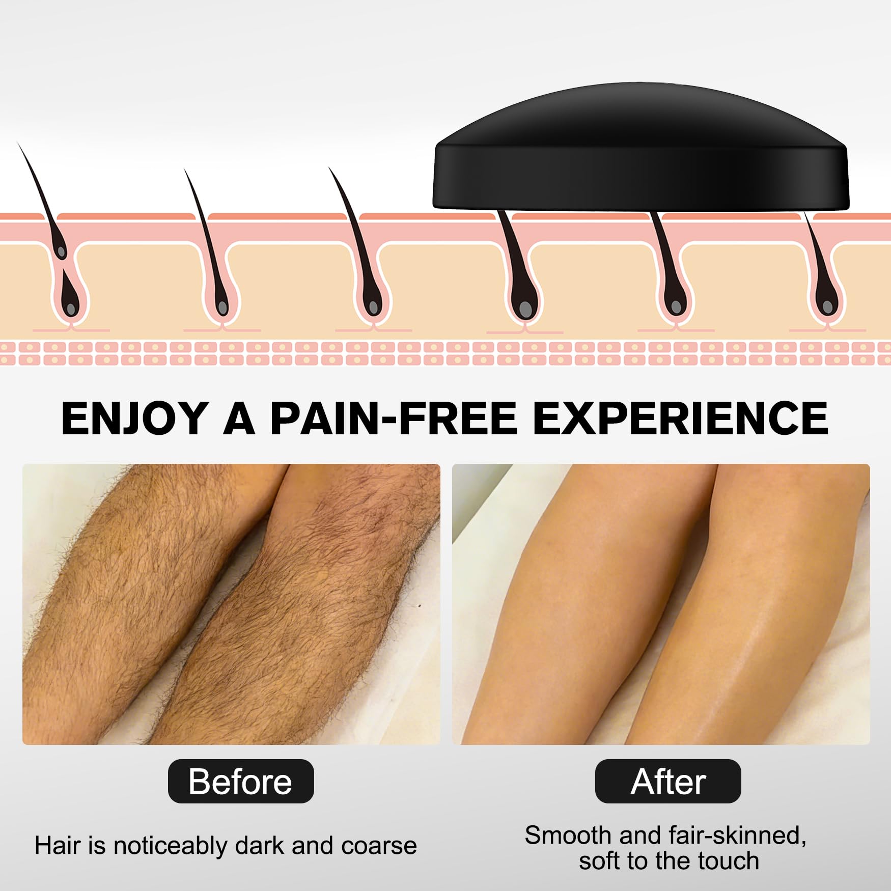 FERYES Nano Crystal Hair Remover with Upgraded Grinding Surface -Reusable Crystal Hair Eraser- Portable - Compact Epilator for Legs Back Arms
