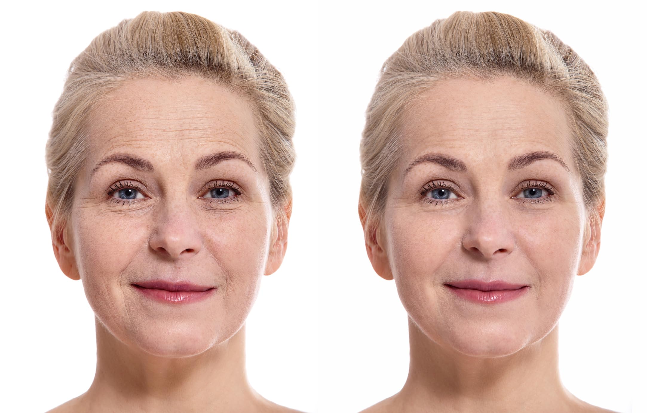 Vitality Precision Skin Micro-Exfoliating Scrub
