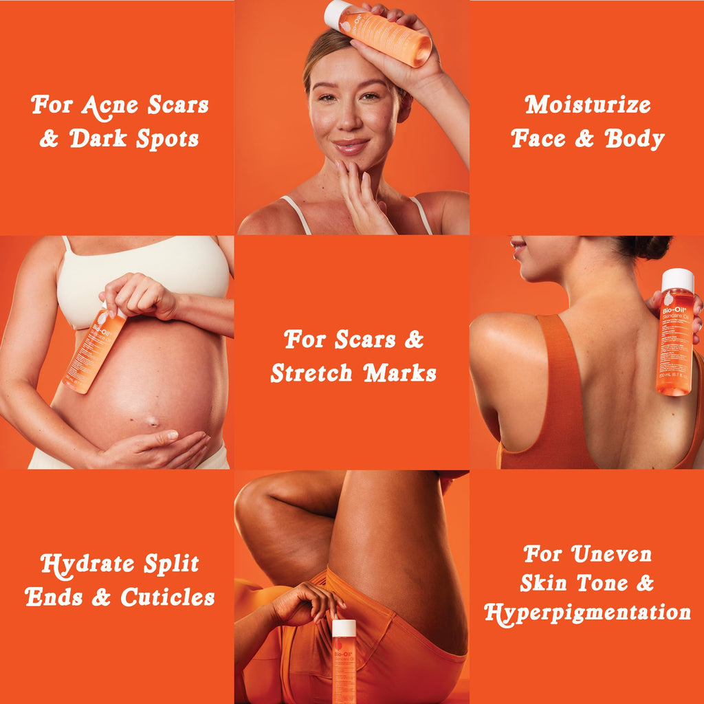 Bio-Oil Skincare Body Oil Serum for Scars and Stretch Marks, Face and Body Moisturizer with Vitamin E & A for Sensitive Dry Skin, Dermatologist Recommended, Non-Comedogenic, 2 oz, Case of 24