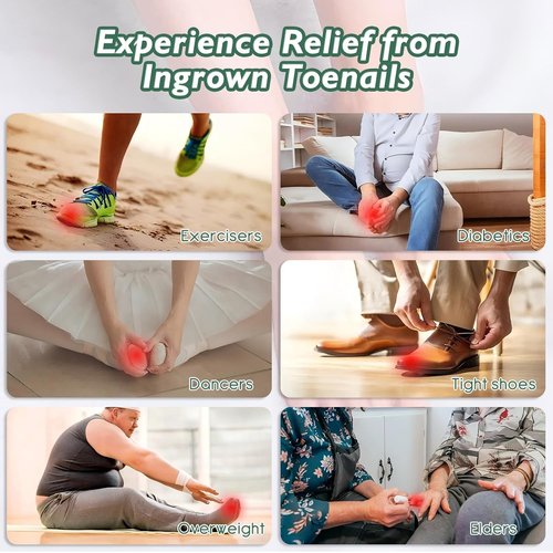 Ingrown Toenail Treatment - 30ml Softening & Conditioning Kit for Easy Trimming with Silicone Gel Toe Caps - Comprehensive Ingrown Toenail Removal Sol