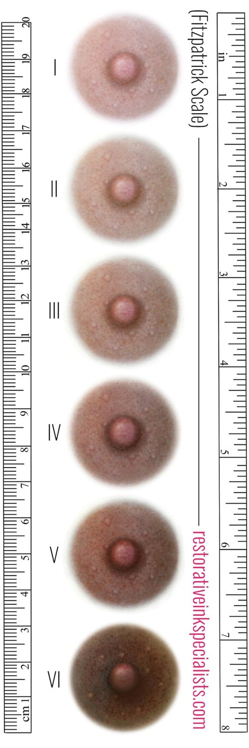 Breast Cancer Areola Temporary Tattoos, Fitzpatrick Colors 1-5, 1.5 inch, 5 pairs (Fitzpatrick #2)