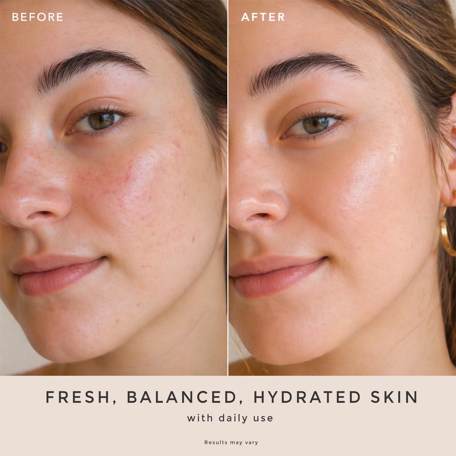 Rose Water Spray for Face - USA Made with Hydrating Natural & Organic Ingredients for Glowing Skin, Alcohol-Free Rosewater Toner Mist with Witch Hazel & Glycerin for Dry and Sensitive Skin