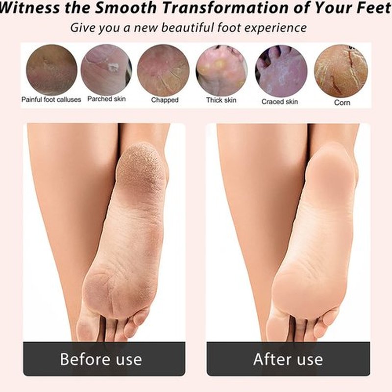 ICDI ICANdOIT Natural Bamboo Foot File Callus Remover-Multi Purpose 4 in 1 Feet Pedicure Kit with Foot Care Boar Bristle Brush,Pumice Stone,Foot Rasp,Sand Paper