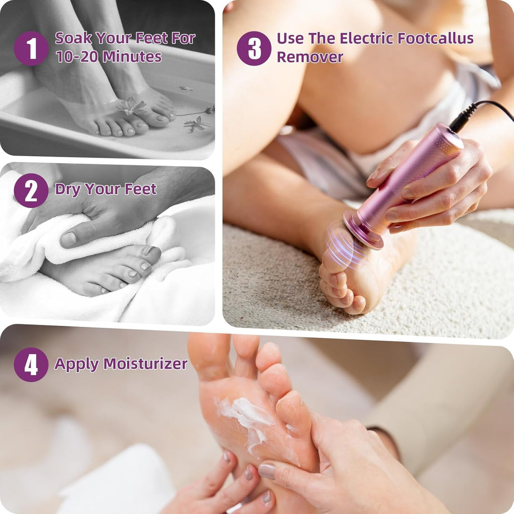 YPWRENH Electric Foot Callus Remover: Feet File Callus Remover with 60pcs Sandpaper Discs - Dead Hard Skin Foot Scrubber for Women -3 Adjustable Speed Pedicure Tools for Feet