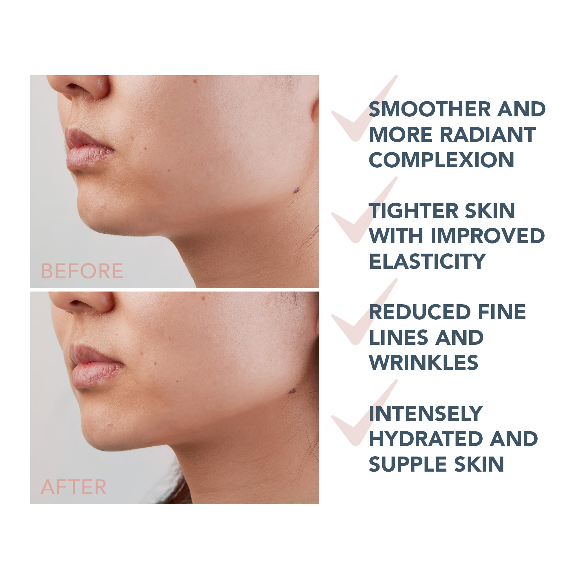 FOREO SUPERCHARGED Triple-Action Firming Serum - Conductive Gel - Hyaluronic Acid & Squalane - Intensely Hydrating Serum for Face - Vegan & Cruelty-free - All Skin Types - 1 fl. Oz