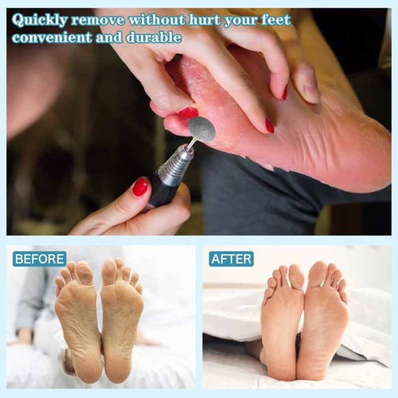 C12rtive Pedicure Drill Bit, Diamond Carbide Foot Nail Drill Bit,Stainless Steel Professional Pedicure Foot Calluses Sanding Polishing Bits for Cracked Skin Callus Removal for Home Salon & DIY(Medium)