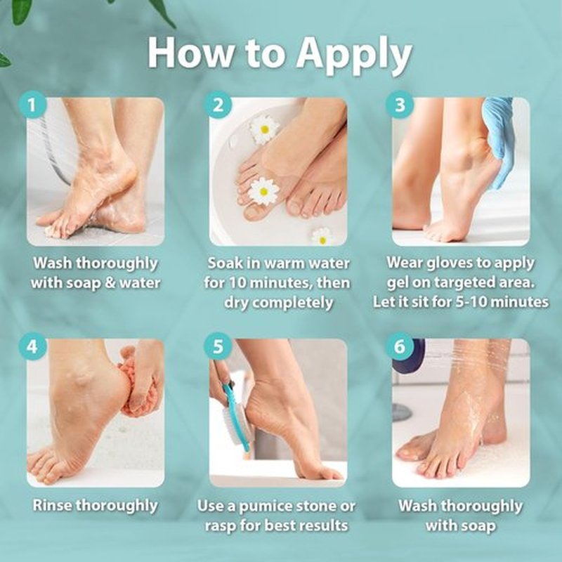 Ebanel Professional Callus Remover Gel - 20% Urea & Salicylic Acid for Smooth Feet | Exfoliates Dead Skin