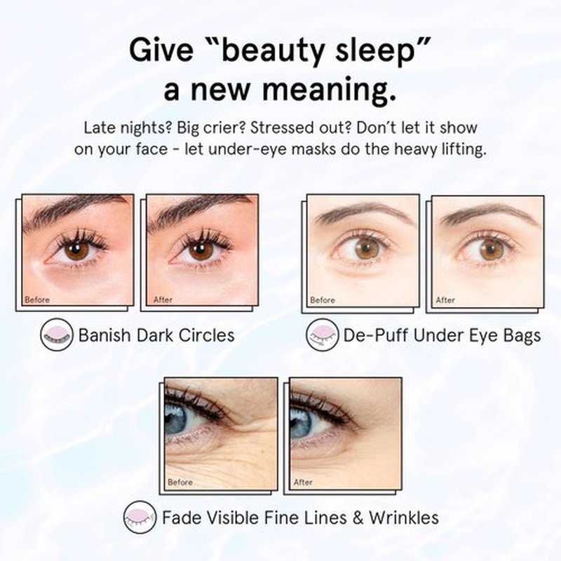 Grace & Stella Retinol Under Eye Patches - Hydrating Gel Masks for Puffy Eyes & Dark Circles | 24 Pairs (Purple)