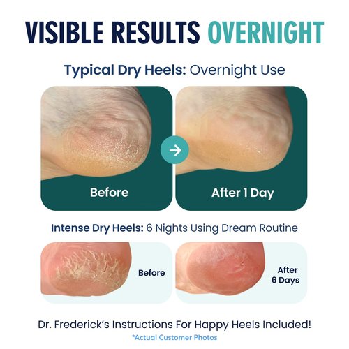 Dr. Frederick's Moisturizing Heel Socks - Olive Oil & Vitamin E Infused - 2 Pairs - Green Aloe for Cracked Heels