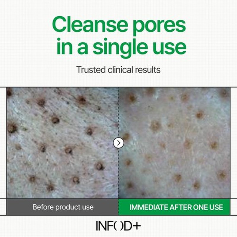 INFODPLUS XCESPI316 Gel Cleanser – Exosome & Walnut Powder Foaming Face Wash for Deep Pore Cleansing, Oil Control & Blackhead Care | Korean Cleanser for Men & Women, 100ml
