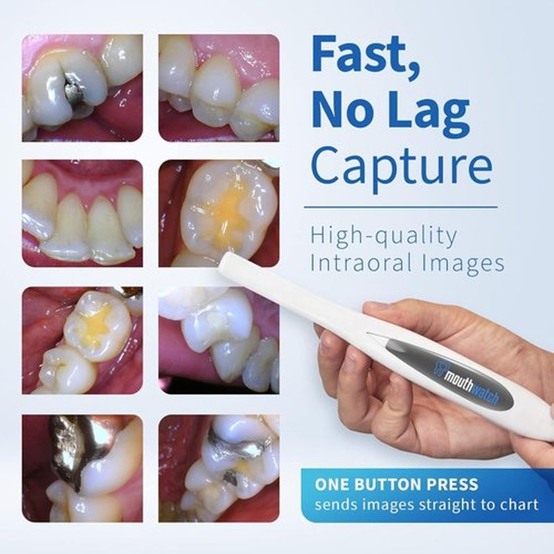 Intraoral Camera - Crystal Clear Images | Easy Single Button Operation, Lightweight & Ergonomic Design