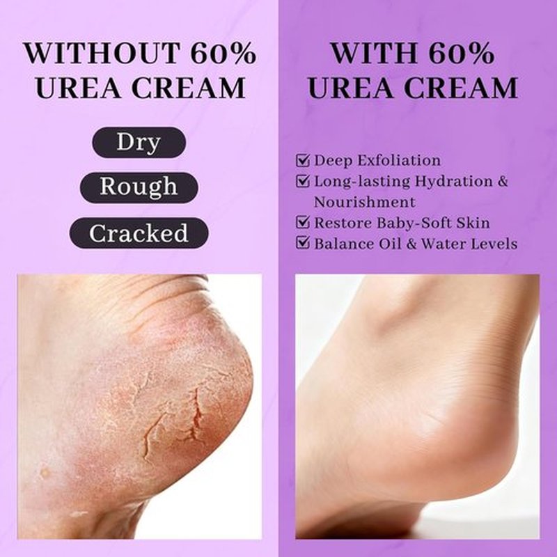 Regine Switzerland 5-in-1 Urea Cream - Maximum Strength 60% Formula with 2% Salicylic Acid for Deep Hydration & Callus Removal | 150g